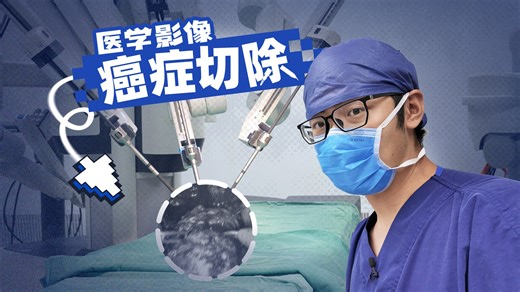 实拍！癌症是怎么被机器人切除的？-亿点点不一样-亿点点不一样-哔哩哔哩视频