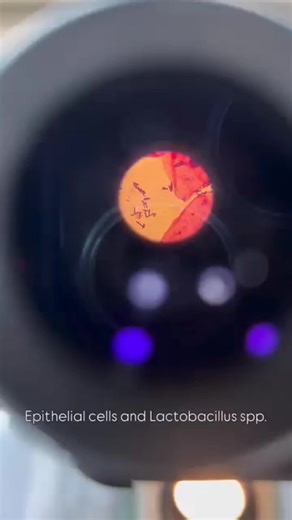 Microbiological analysis of vaginal swab : Lactobacillus and epithelial cell in vaginal smear