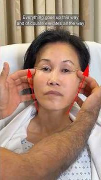 60-Year-Old Facial Rejuvenation Pre-Op Plan