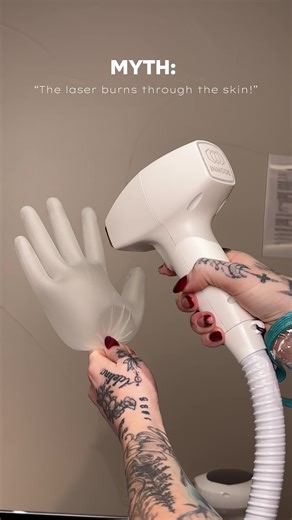 Effective Laser Hair Removal for Dark Hair Explained