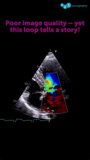 Based on the loop shown here, which statement seems true? 🫣💡