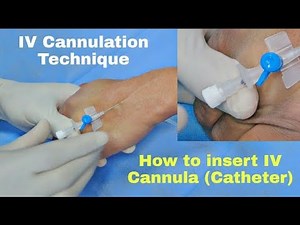 Intravenous (IV) Cannulation