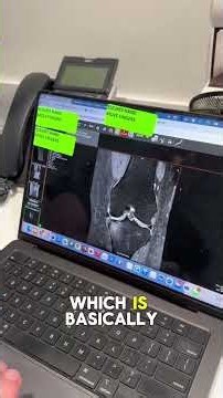 MRI to the OR - Ossio Knee Bar #MRI #Surgery #Knee #Biologic #Orthopedics ￼