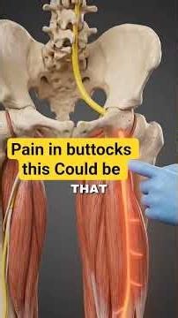 pain in buttocks