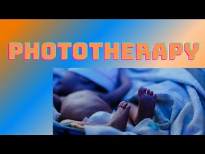 Phototherapy treatment for jaundice in NICU
