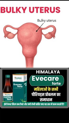 evecare forte Syrup. #EvecareSyrup #Pid #pcod #pcos #periodproblems #drbabitarathore