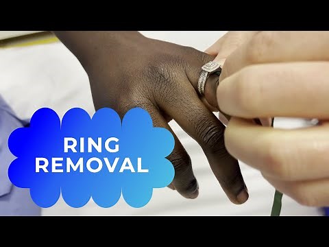 How to get a stuck ring off a swollen finger (ring removal)