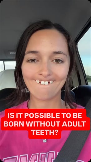 Dr. Buchbinder explains why some adults are missing their permanent teeth and how to fix it. #missingteeth #dentist #orthodontist #veneers #funfacts | Clark Pediatric Dentistry & Orthodontics | Facebook