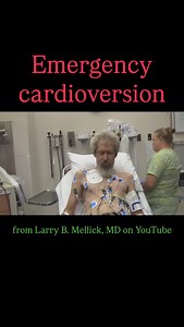 Synchronized cardioversion is simply a well-timed defibrillation. While it typically starts at lower doses, synchronization can occur at any energy level. When we hit “sync,” the monitor identifies the patient’s R waves. When we hit the shock button, we hold it and the monitor will deliver a shock on the next R wave (in contrast to a defib that full sends as soon as we hit the button). Why? In order to miss the relative refractory period: the second half of the T wave where stimulation can cause