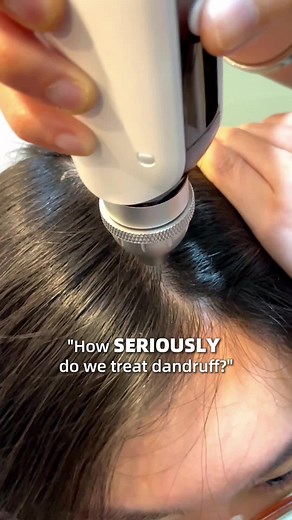 Effective Dandruff Treatment Methods Revealed!