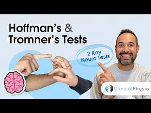 Hoffman's Test and Tromner's Sign | Expert Physio explains crucial Upper Motor Neuron Lesion Tests!