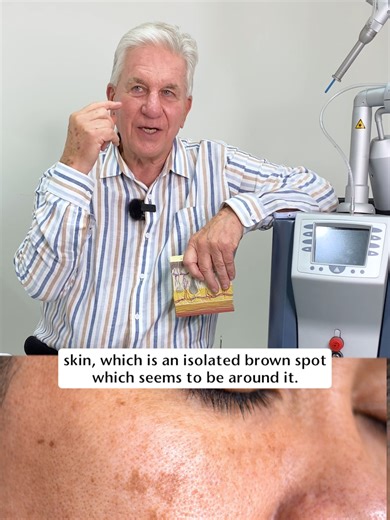 Effective Pigmentation Treatment with Q-Switched Laser