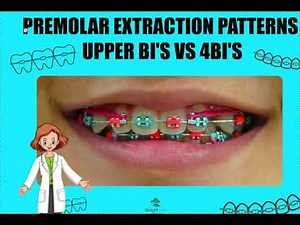 A Guide to Premolar Extractions