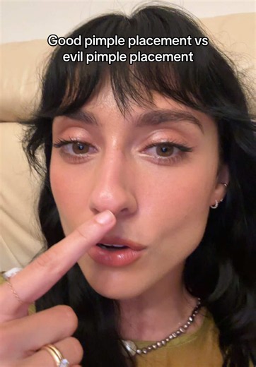 Good pimple placement vs evil pimple placement: do pimples ruin your look?