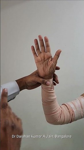 Ulnar claw hand - Knuckle bender splint