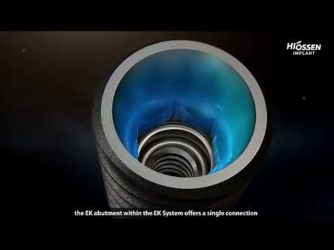 EK IMPLANT SYSTEM