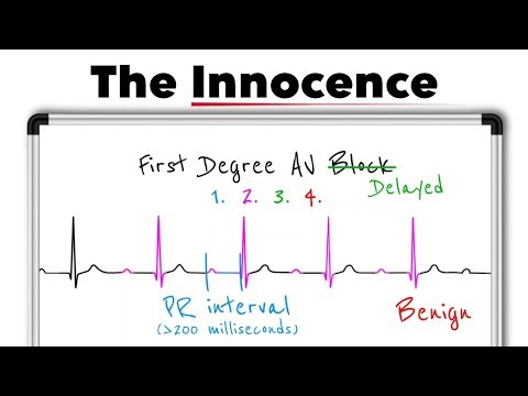 First-Degree AV Block Explained | ECG Interpretation, PR Interval & Clinical Significance