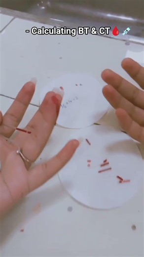 Physiology Practical of Calculating Bleeding & clotting time🩸💉❤️‍🩹#coagulation#physiologicalfacts🎓