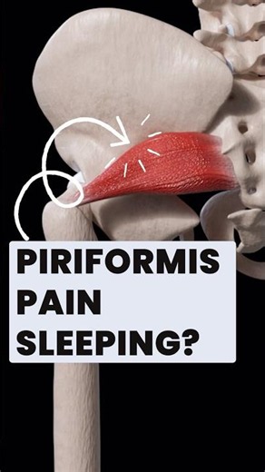Easy Technique to STOP Piriformis Pain Sleeping (Deep Gluteal Pain)