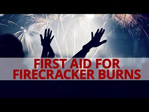 How to do First Aid for Firecracker Burns? #BeALifesaver