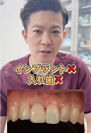 歯が1本抜けた！ 入れ歯でもなくインプラントでもない治療法とは！？ しかもこれが保険適応！？ #歯医者 #インプラント #入れ歯 #保険治療 #ブリッジ