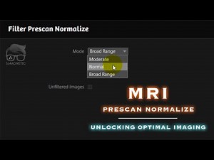 MRI – PRESCAN NORMALIZE : UNLOCKING OPTIMAL IMAGING