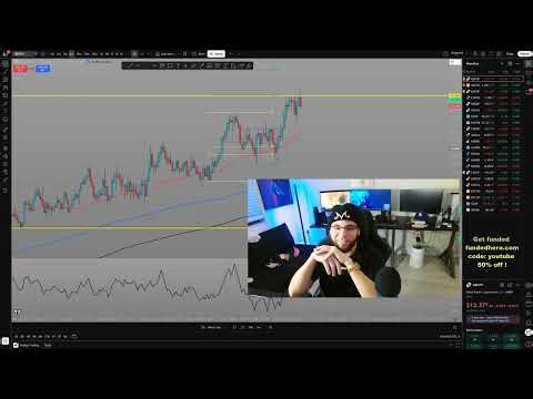 Opening up about my trading journey and life !