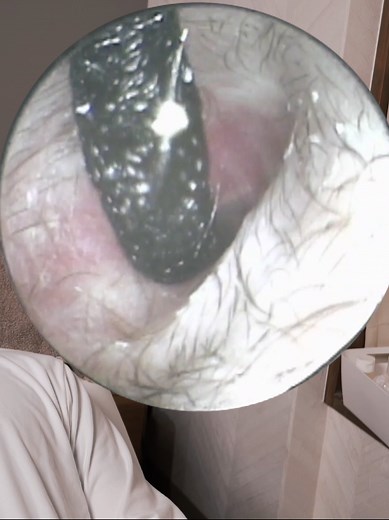 Professional Earwax Removal in Tokyo: ASMR Cleaning Experience