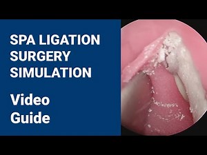 SPA Ligation Surgery Simulation | PHACON Sinus Patient