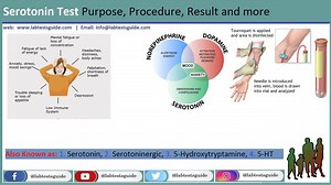 Serotonin | Lab Tests Guide