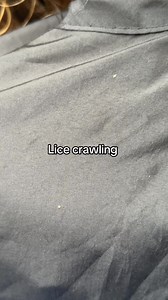 Lice crawling l why my clients always wear capes when I treat them for lice #momlife #hair #piojos #explore | Lousy Stacey