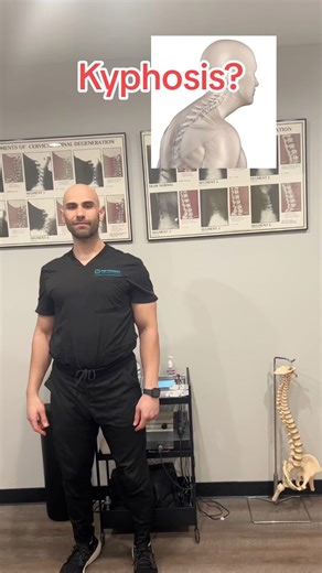78K views · 1K reactions | Kyphosis / Bad Posture? Try this and share! #kyphosis #kyphosisexercises #posture #badposture #posturetips #forwardheadposture #roundedshoulders #lifehacks #helpfultips #viral | Prime Performance Chiropractic & Wellness Clinic | Facebook