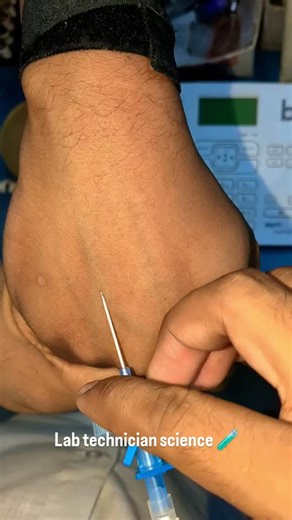 LAB TECHNICIAN SCIENCE 🧪🔭 on Instagram: "𝐅𝐨𝐥𝐥𝐨𝐰 𝐟𝐨𝐫 𝐦𝐨𝐫𝐞 😌❤️🧪🩺 । । । Disclaimer ✅ This content is shared solely for educational and informational purposes. We do not claim ownership of the original material. Full credit and rights belong to the respective owner. 🛑 Dm me for credit and removals . . #LabTechnicianLife #MedicalScience #Science #LaboratoryWork #HealthcareHeroes #LabLife #ScienceMatters #LabTechnician #jaipurcity #HealthcareSupport #MedicalLabTech #jaipur #Neetug20