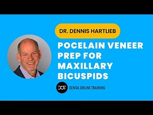 Porcelain Veneer Preparation for Maxillary Bicuspids | Prep-less Technique | Dental Online Training