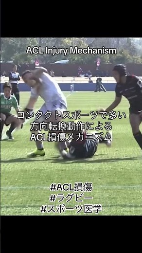 ACL Injury Mechanism – Contact Sports