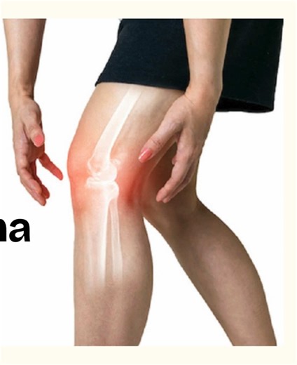 Understanding Osteosarcoma: Symptoms and Causes