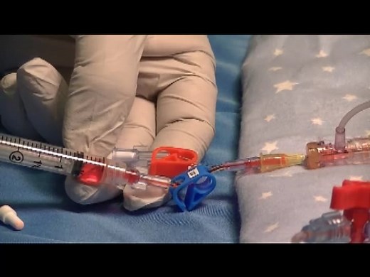 UAC Draw w Aspirating Syringe