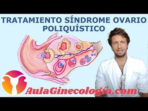 Polycystic Ovary Syndrome: Treatment... Fertility and Pregnancy - Gynecology and Obstetrics -