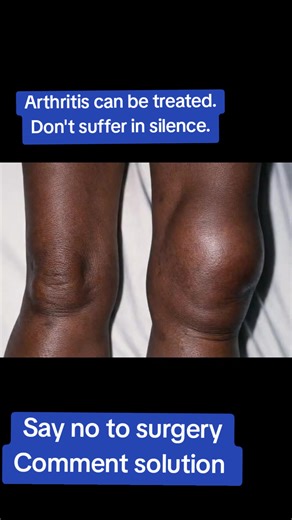 Effective Solutions for Treating Arthritis Pain