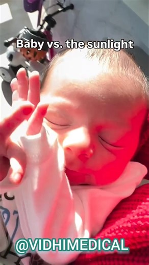 Baby vs the sunlight reaction 😮 #vidhimedical #newbornbaby