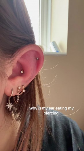 Understanding Piercing Infections: Ear Piercing Issues Explained