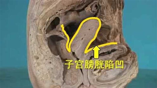 膀胱的位置形态及结构