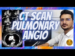 CT SCAN || Pulmonary angio filming process #angiography #pulmonary #radiologytechnologist