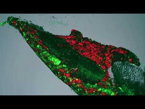 RWTH Aachen: LMF – die Light Microscopy Facility des IZKF Aachen