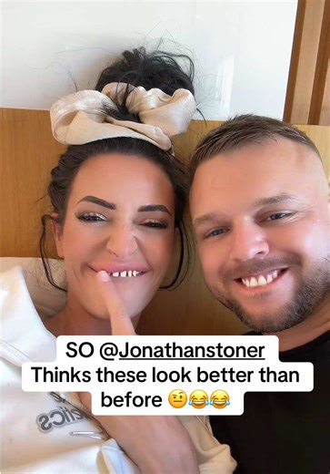 Funny Baby Shark Teeth Transformation Updates