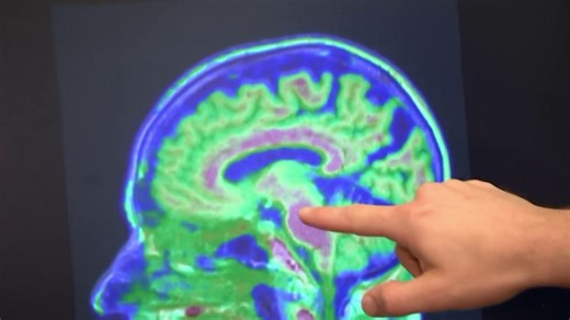 Study finds brain training games may help protect against dementia