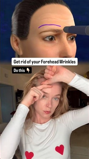 Stop Botox! Erase Forehead Lines Naturally. #shorts