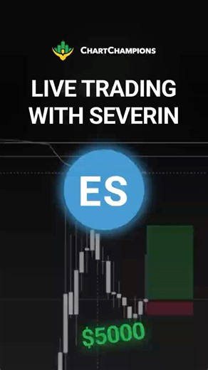 Live Trade Execution Inside Chart Champions