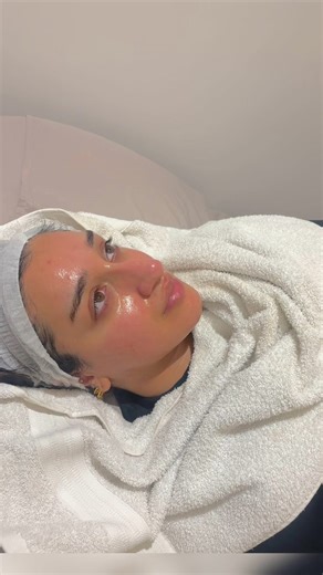 Exploring Different Types of Skin with HydraFacial Treatments