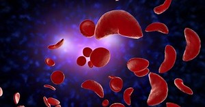 FDA considers gene-editing treatment for sickle cell disease